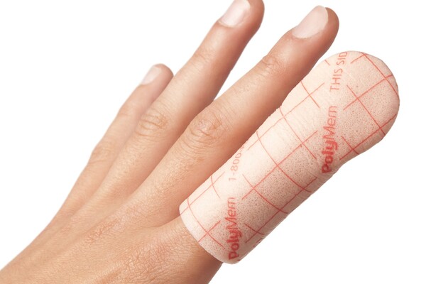 PolyMem vinger/teenverband vergoeding CZ